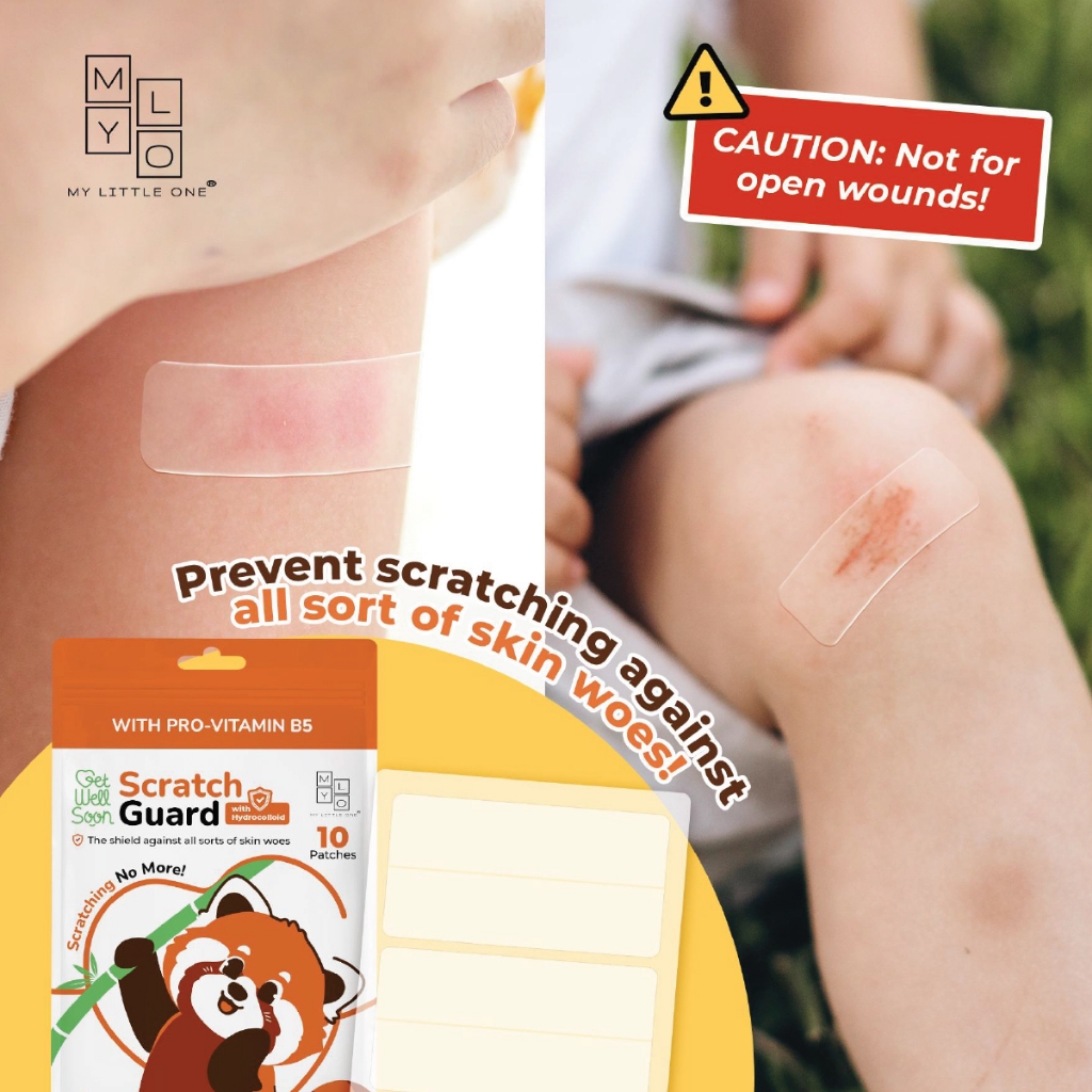 MyLO ScratchGuard Relief Patch (10 patches / pouch) - Hydrocolloid & Pro-Vitamin B5
